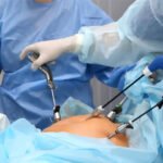 Advanced Laparoscopy Treatment