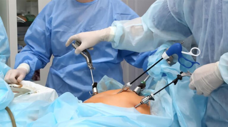 Advanced Laparoscopy Treatment