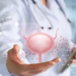 bladder cancer treatment